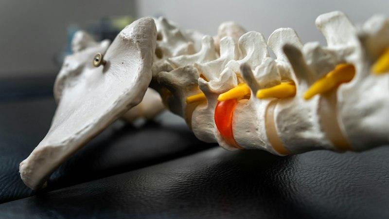Maqueta d'una columna vertebral humana amb detalls en groc i taronja